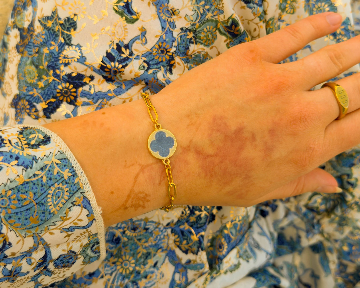 Blue Serenity Armband